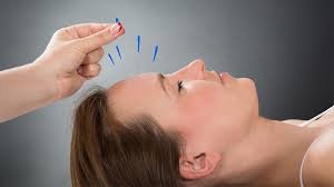Balancing Point Acupuncture